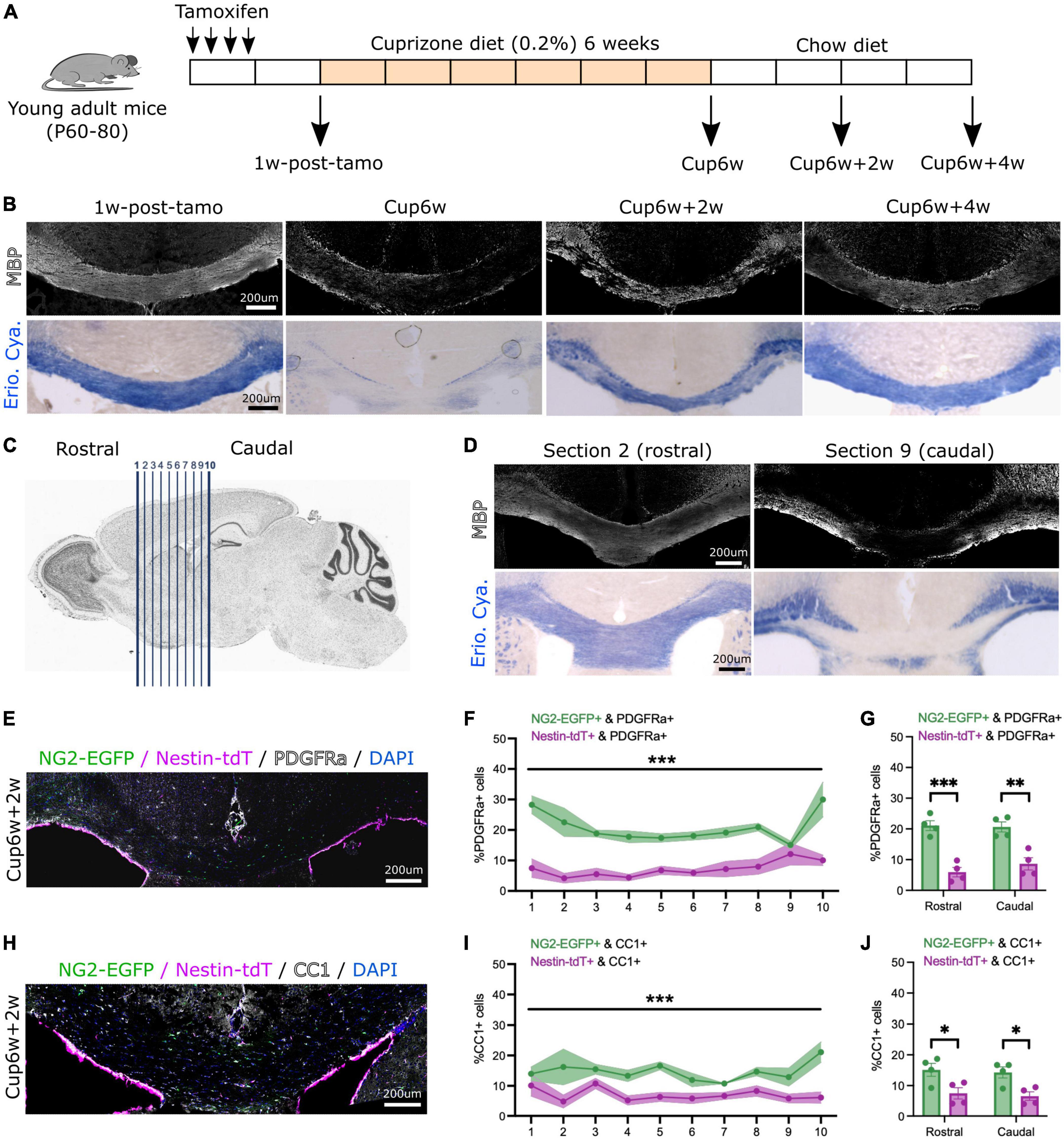 Neural stem cells and oligodendrocyte progenitor cells compete for remyelination in the corpus callosum